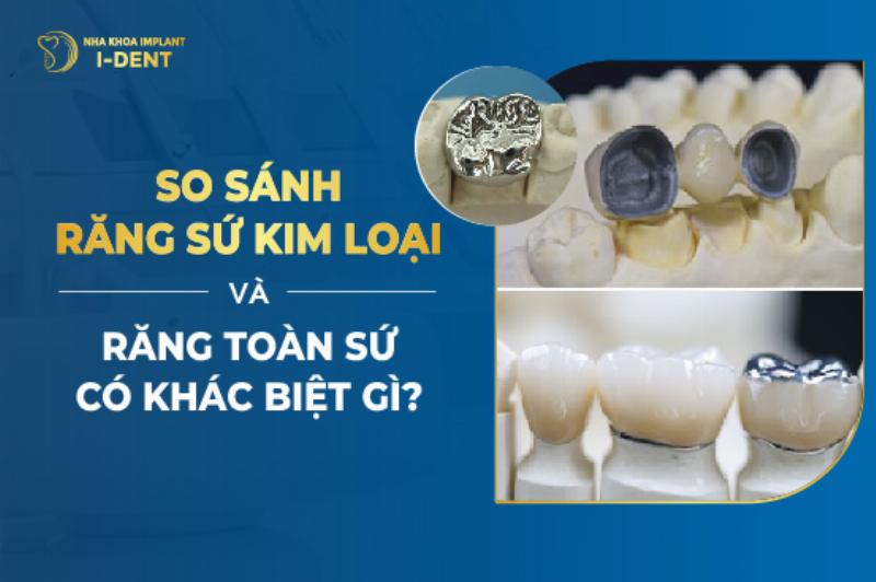 So sánh sự khác nhau giữa kim loại đen và kim loại màu qua màu sắc và tính chất điển hình